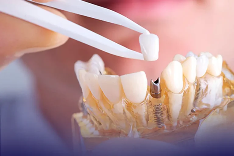 cecape-news-banner-noticia (4)